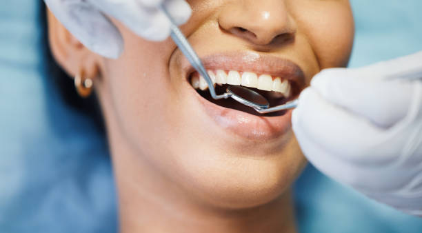 Best Emergency Treatment for Dental Infections or Abscesses in Harsville, RI